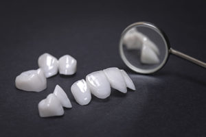 dental mirror and dentures on a dark background - ceramic veneers - lumineers